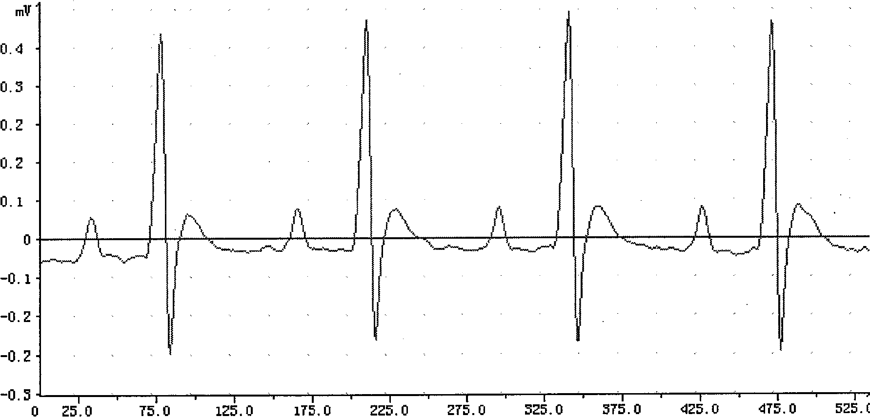 Application of coptisine in preventing and curing myocardial ischemic diseases