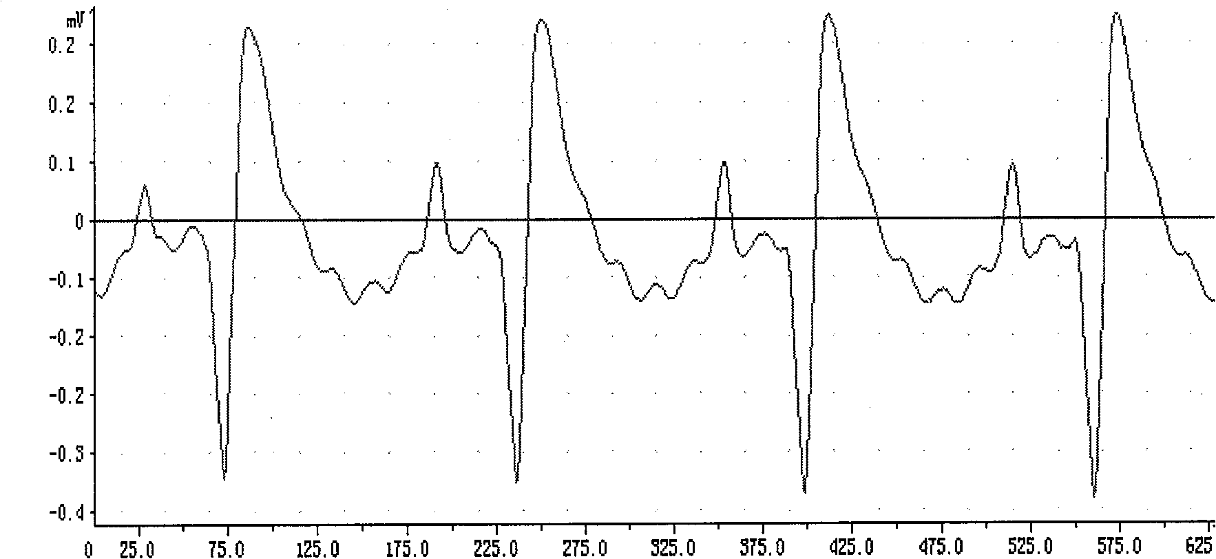 Application of coptisine in preventing and curing myocardial ischemic diseases