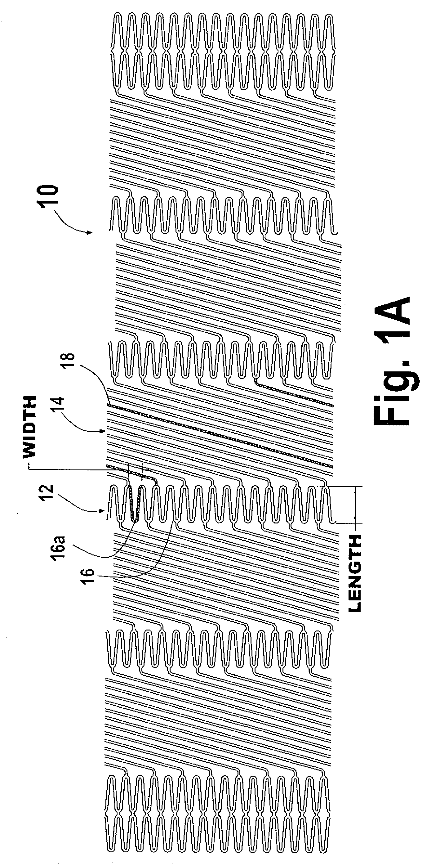 Flexible stent