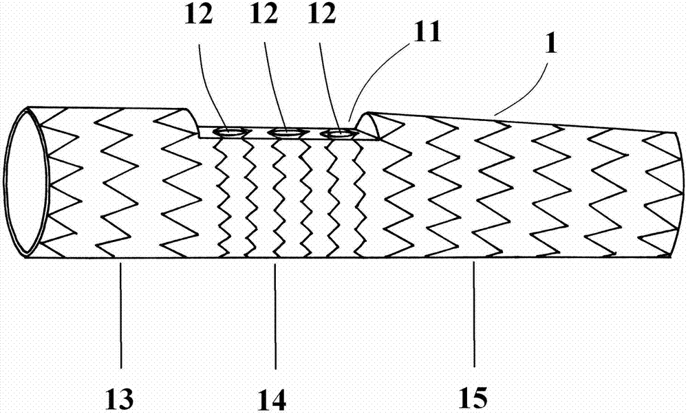 Branched aortic stent vascular system