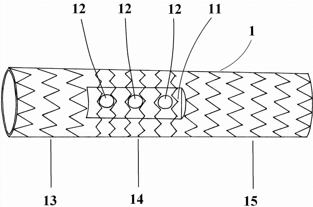 Branched aortic stent vascular system