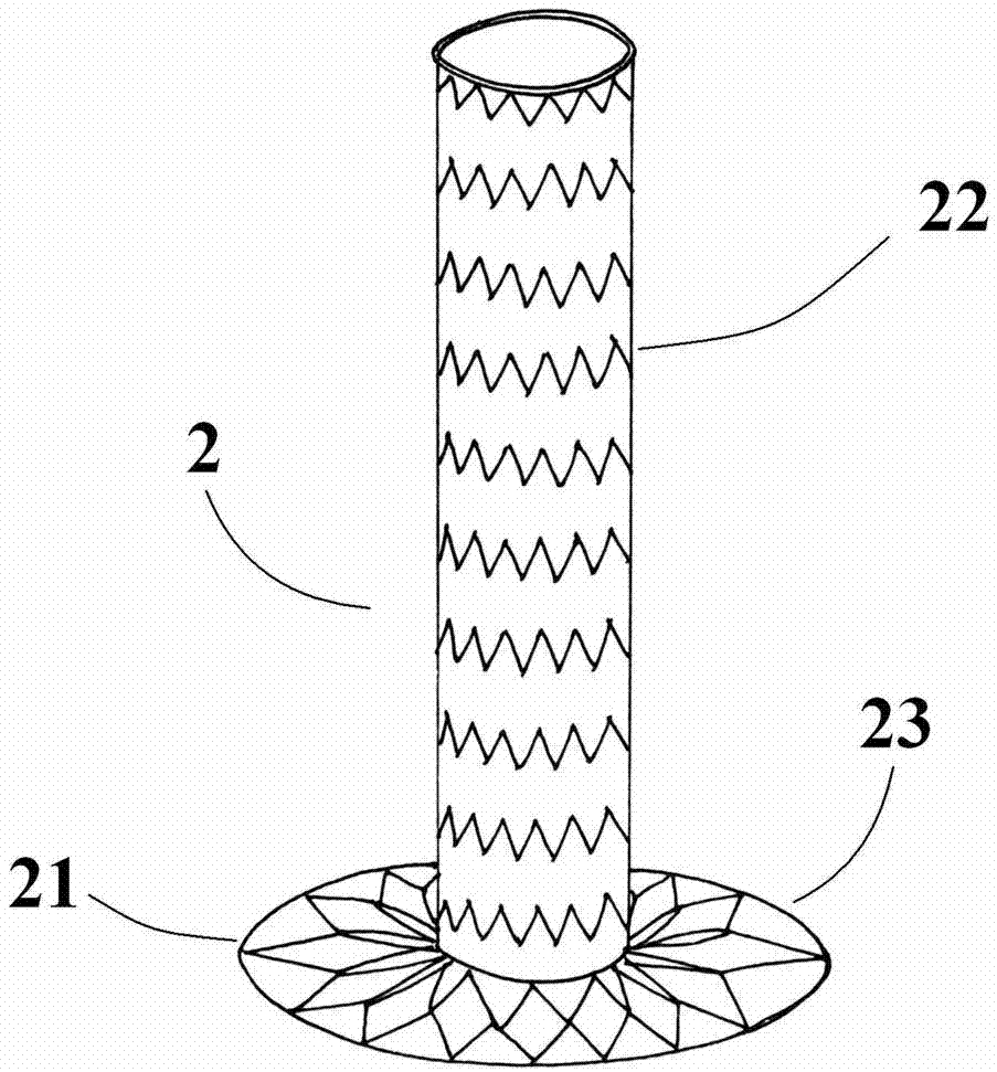 Branched aortic stent vascular system