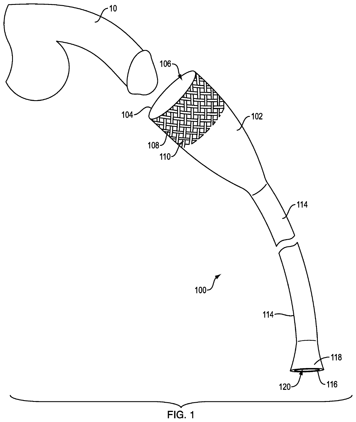 Male catheter