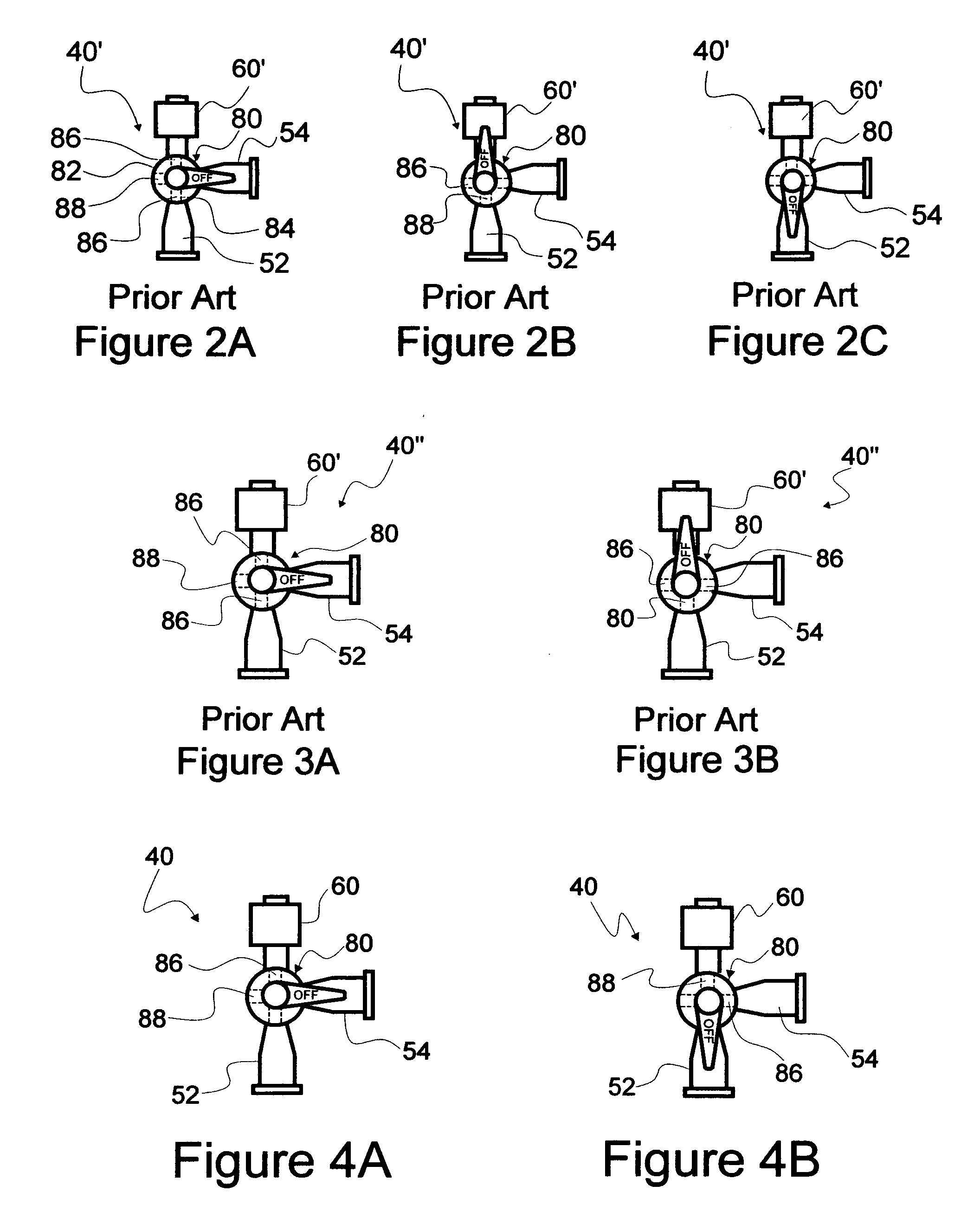 Convenience IV kits and methods of use