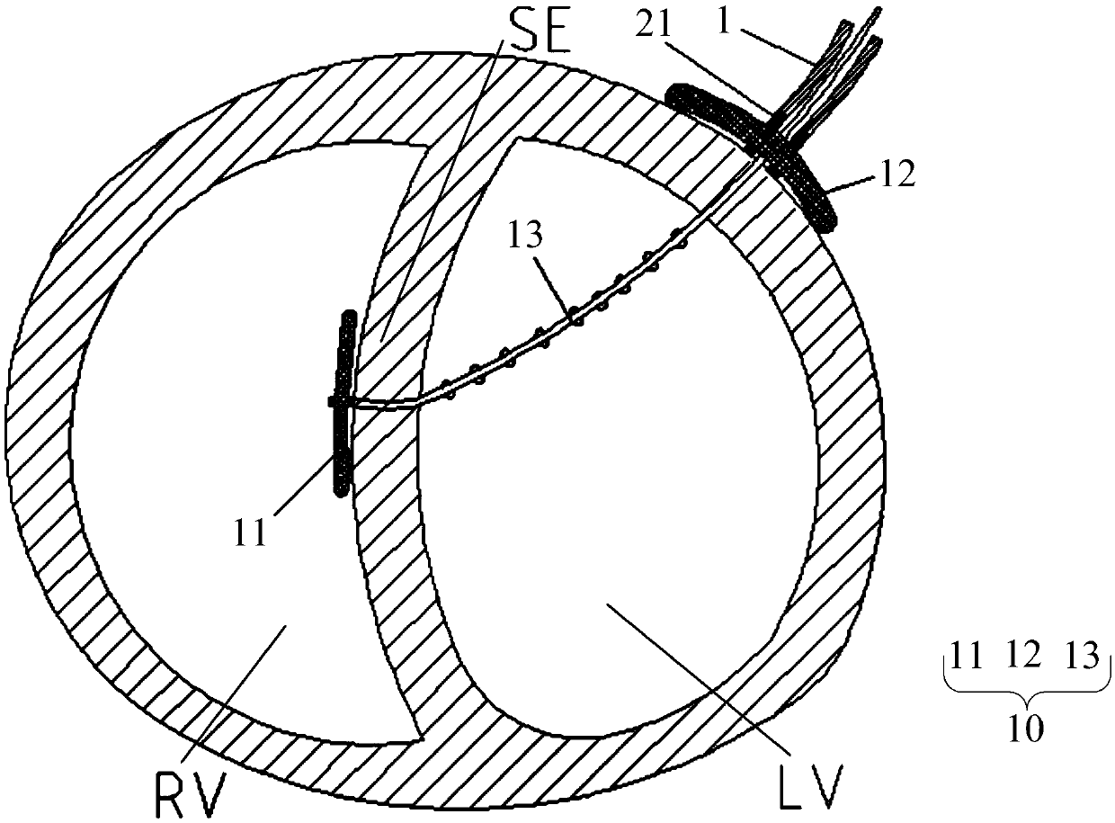 Medical handle, medical conveying device and myocardial anchoring system