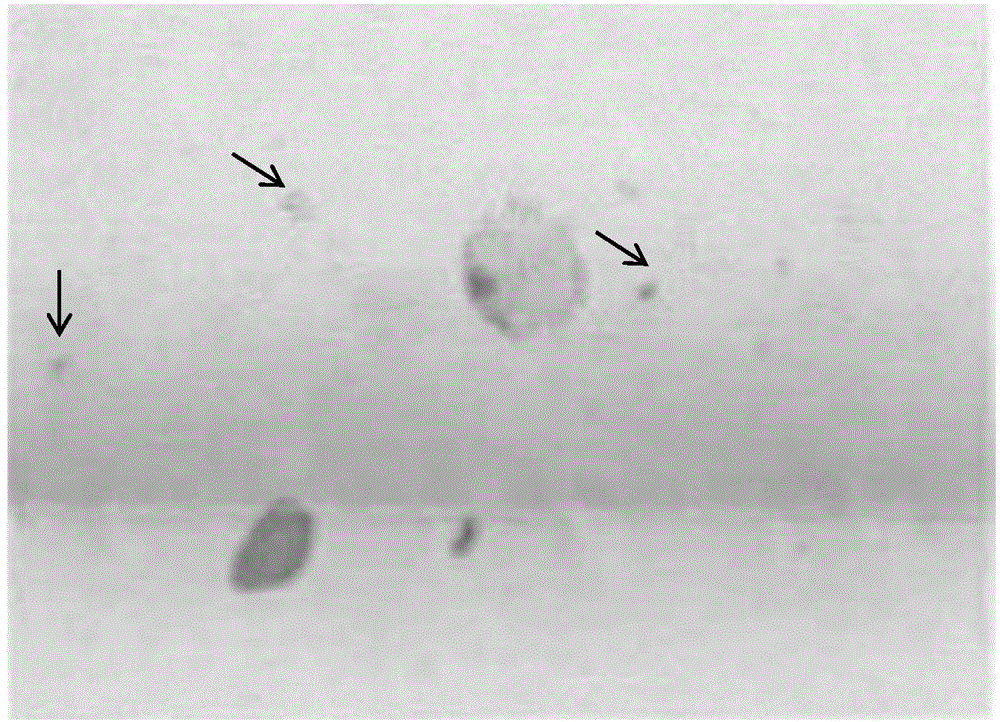 Exfoliative cell sap base preserving fluid, method thereof for flaking and kit