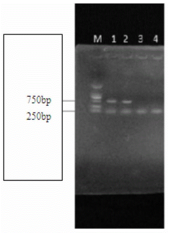 Duplex PCR method for detecting porcine transmissible gastroenteritis virus and porcine epidemic diarrhea virus