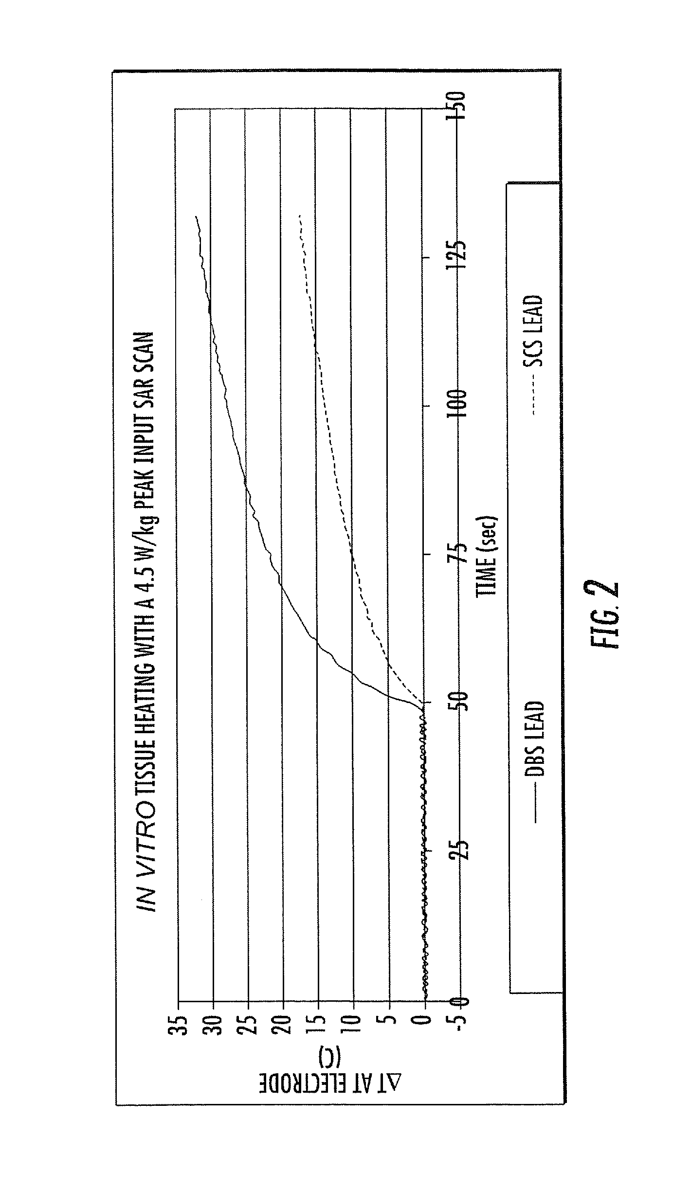 MRI and RF compatible leads and related methods of operating and fabricating leads