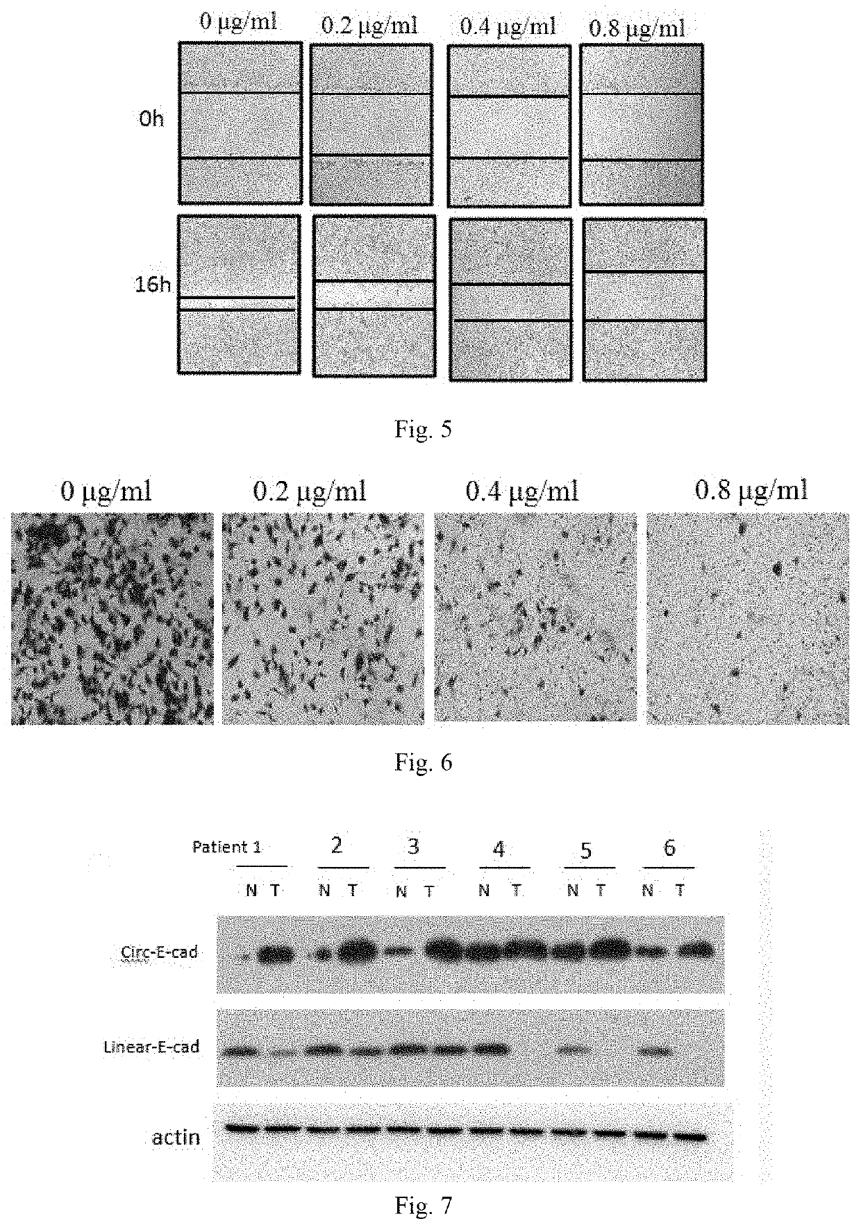 Use of Circ-CDH1 inhibitors