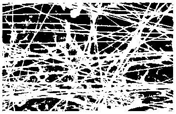 Preparation method of nano fiber double layer support used for skin tissue engineering