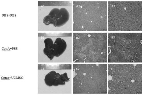 Application of umbilical cord mesenchymal stem cells in preparation of medicine for treating novel coronal pneumonia