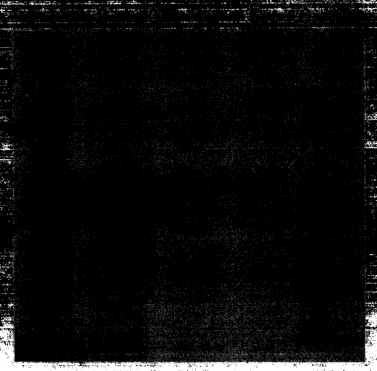 Tubercle bacillus fusion protein and preparation method and application thereof