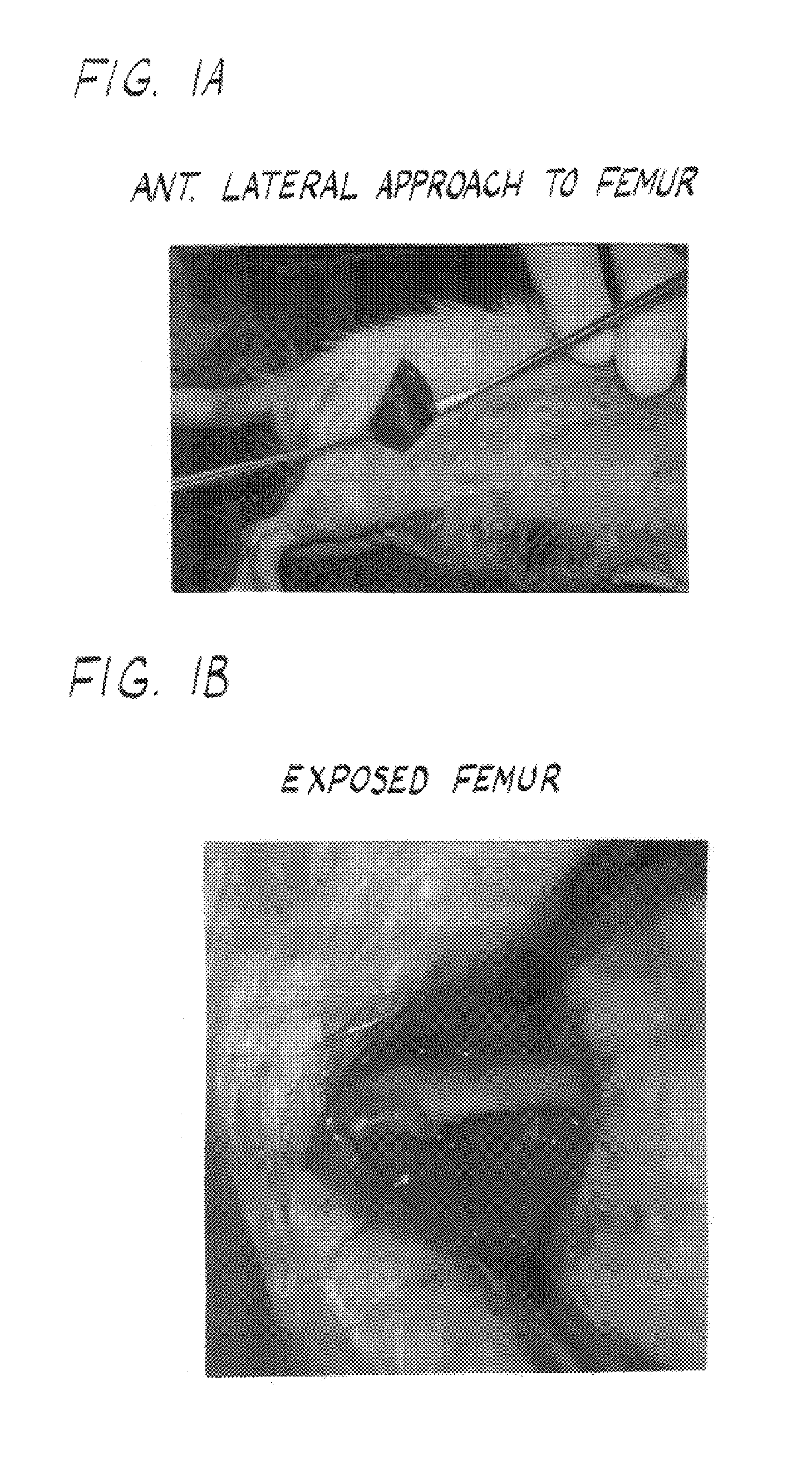 Compositions and methods for forming and strengthening bone