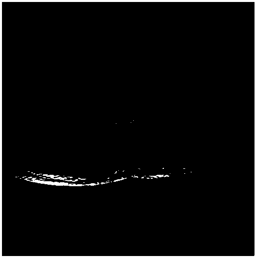 A method for determining an abnormal type of a spinal cross-section image and computing equipment