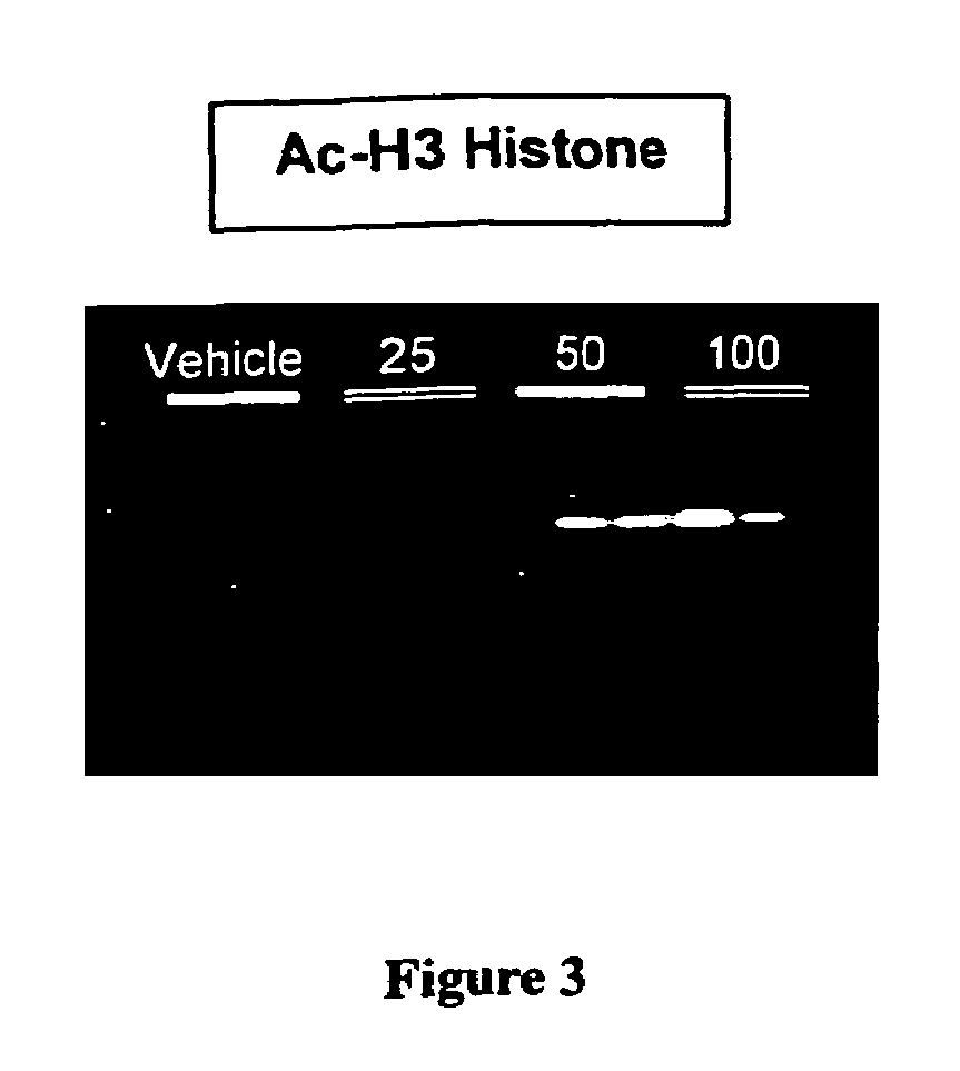 Multicyclic sulfonamide compounds as inhibitors of histone deacetylase for the treatment of disease