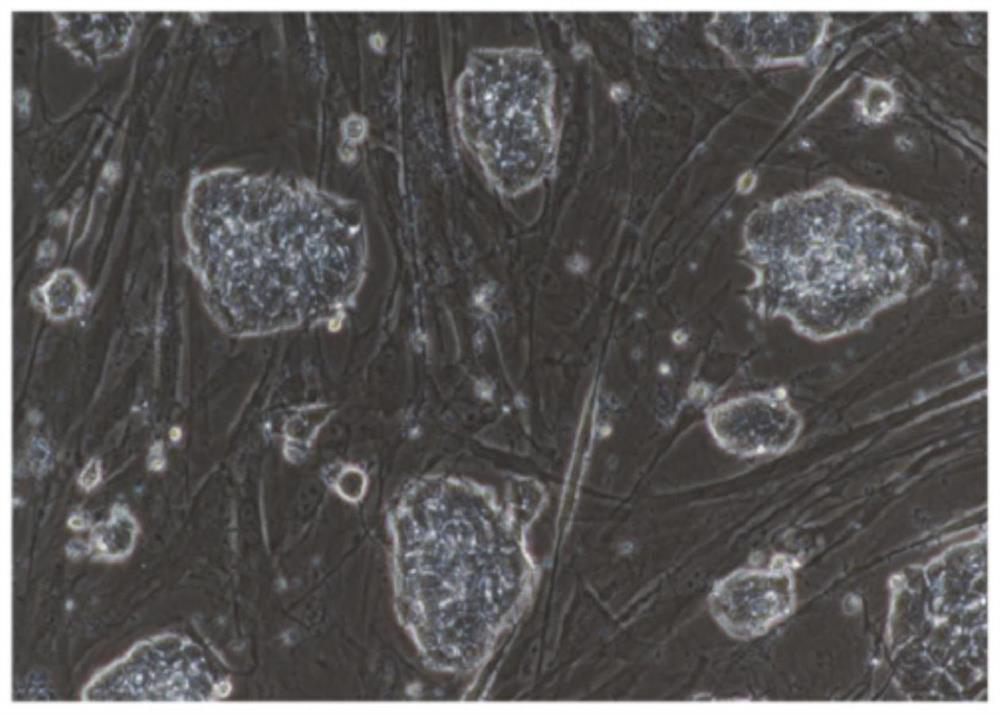 Line establishment method and culture solution for bovine expanded pluripotent embryonic stem cells