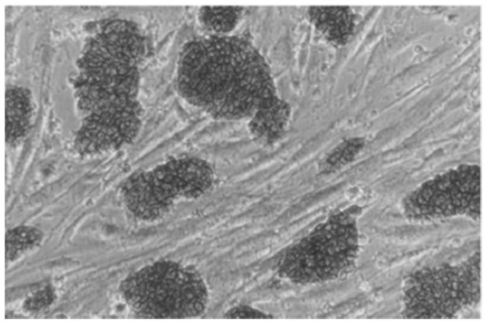 Line establishment method and culture solution for bovine expanded pluripotent embryonic stem cells