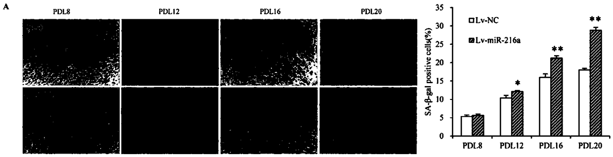 Application of miR-216a and target gene thereof in vascular senescence and atherosclerotic heart disease