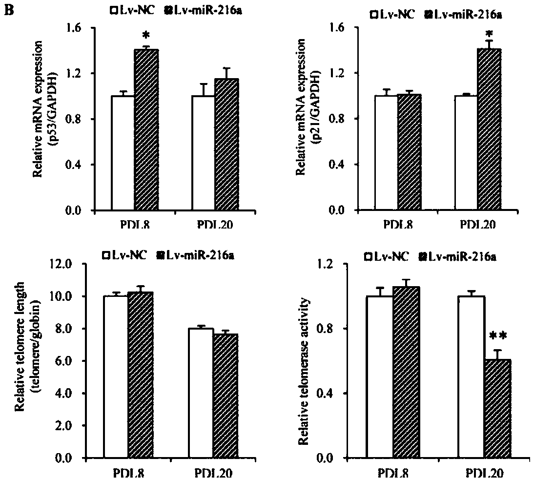 Application of miR-216a and target gene thereof in vascular senescence and atherosclerotic heart disease