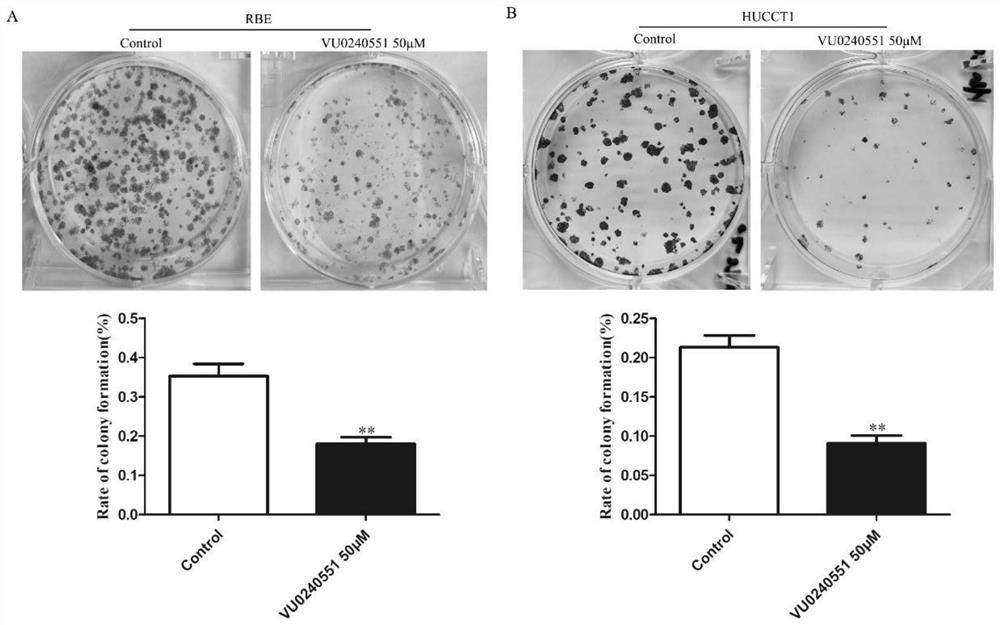 Application of SLC12A5 and inhibitor thereof