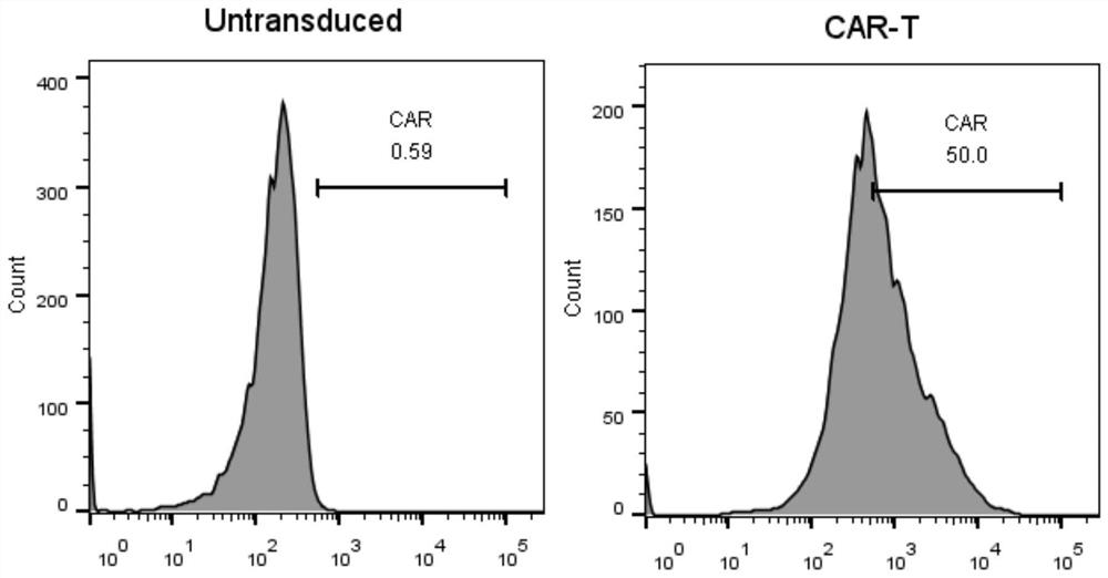 Chimeric antigen receptor based on human mesothelin antibody, lentiviral expression vector and its application