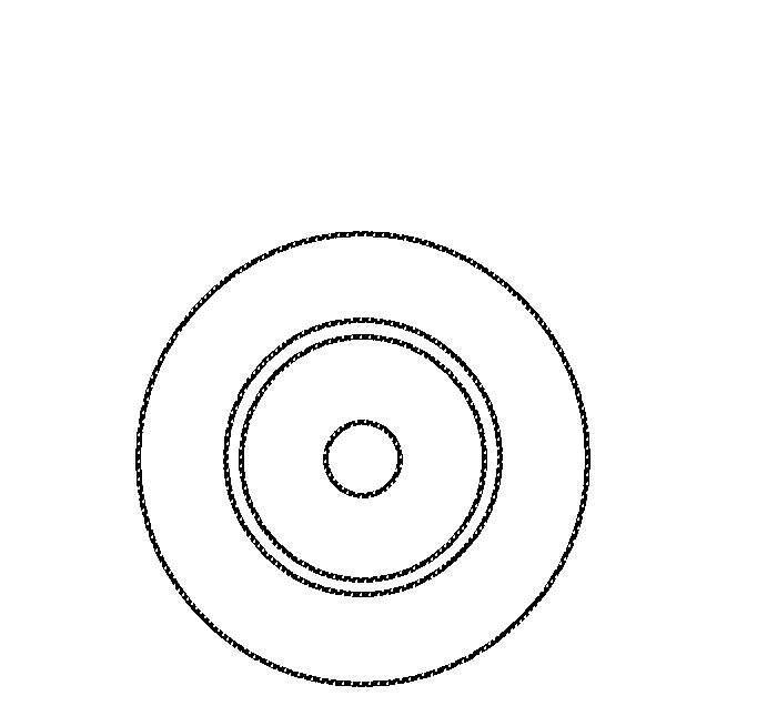 Microvalve protection device and method of use for protection against embolization agent reflux