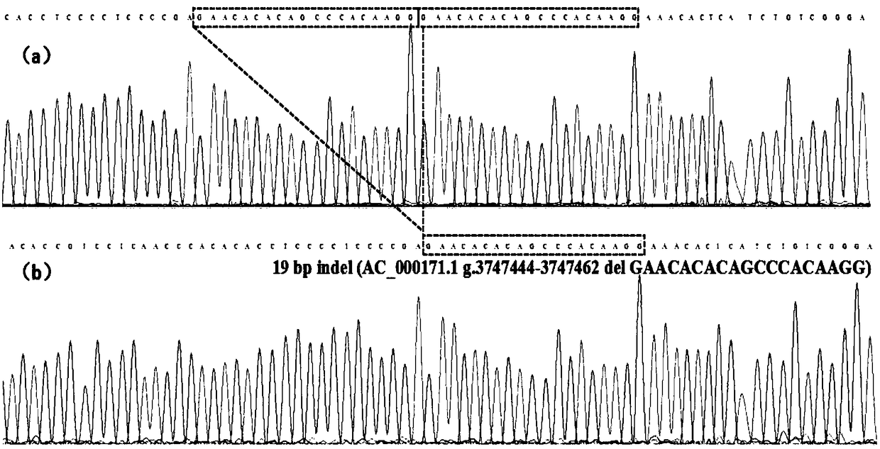 Detection method for 19-bp duplication and deletion polymorphism of Chinese yellow cattle PLAG1 (Pleomorphic Adenoma Gene 1) gene and application of detection method