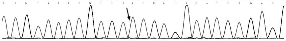 Mutated genes associated with hereditary glomerular diseases and their applications