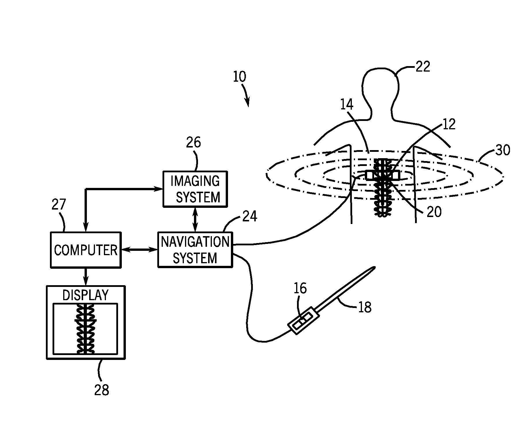 Surgical navigation planning system and method for placement of percutaneous instrumentation and implants