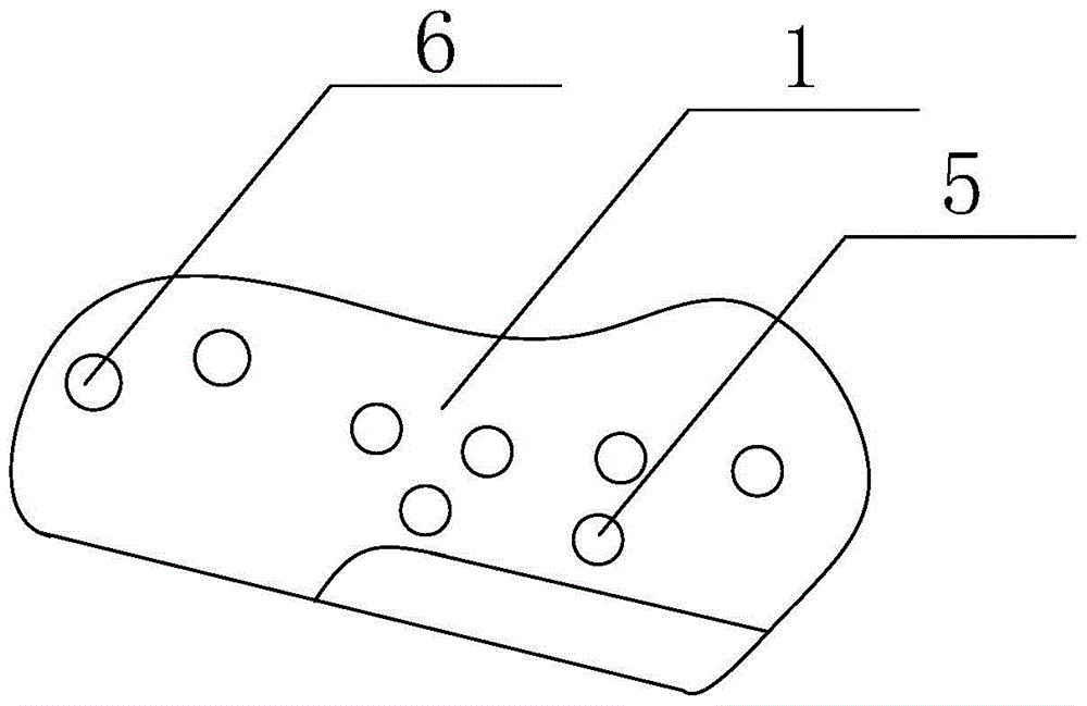 A bone modification guide plate assembly for artificial temporomandibular joint replacement