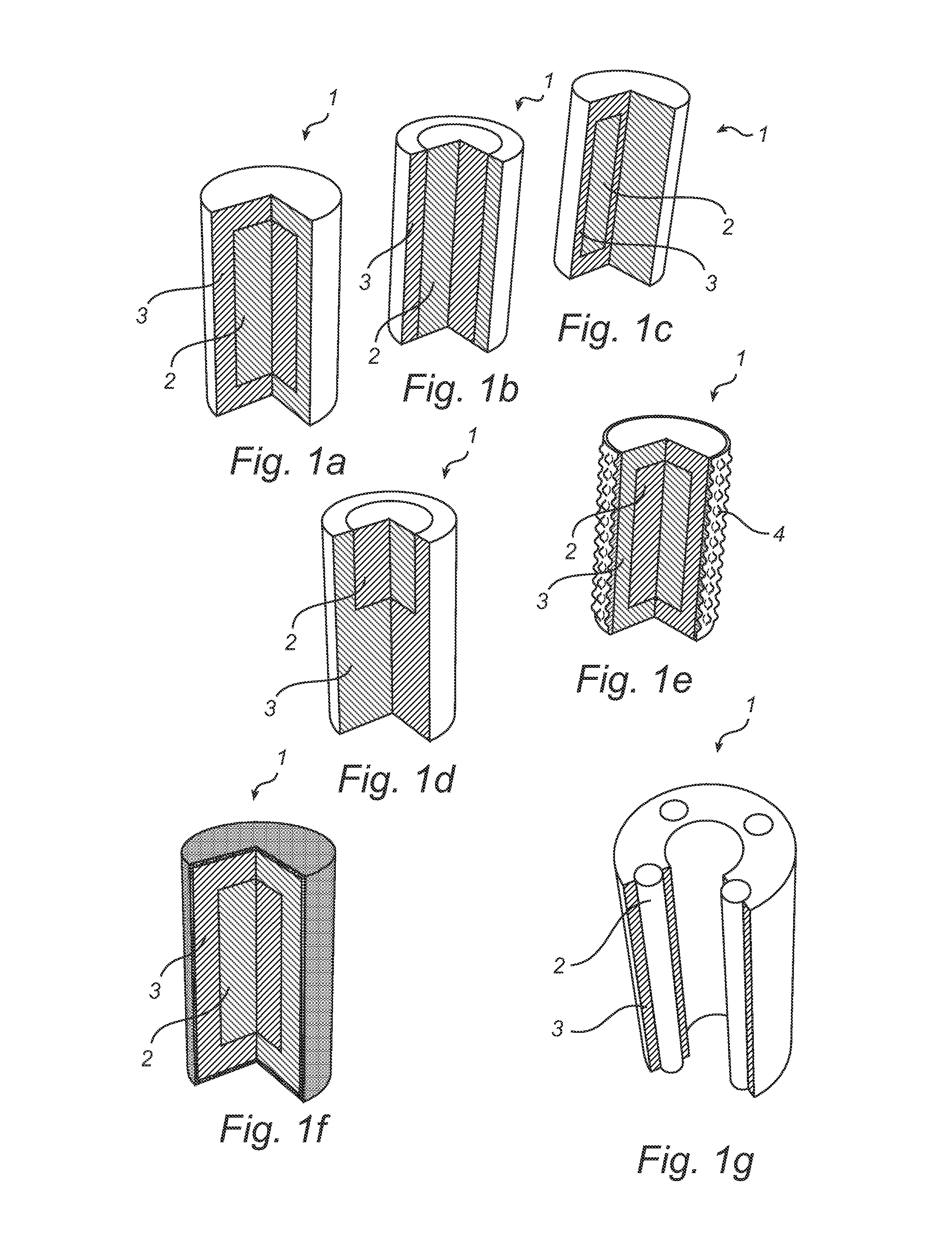 Bimaterial elongated insert member for a grinding roll