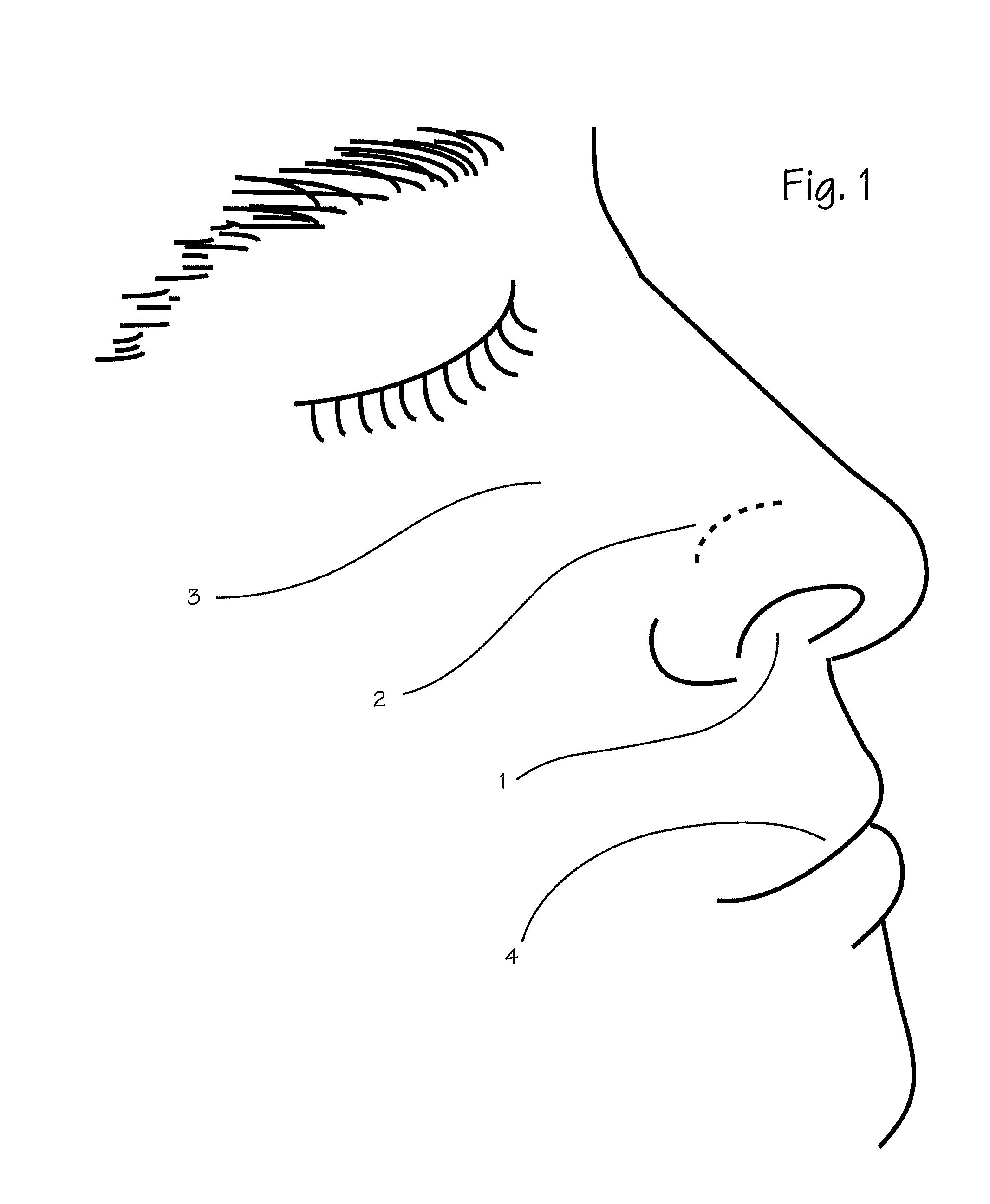 Device and method for nasal surgery