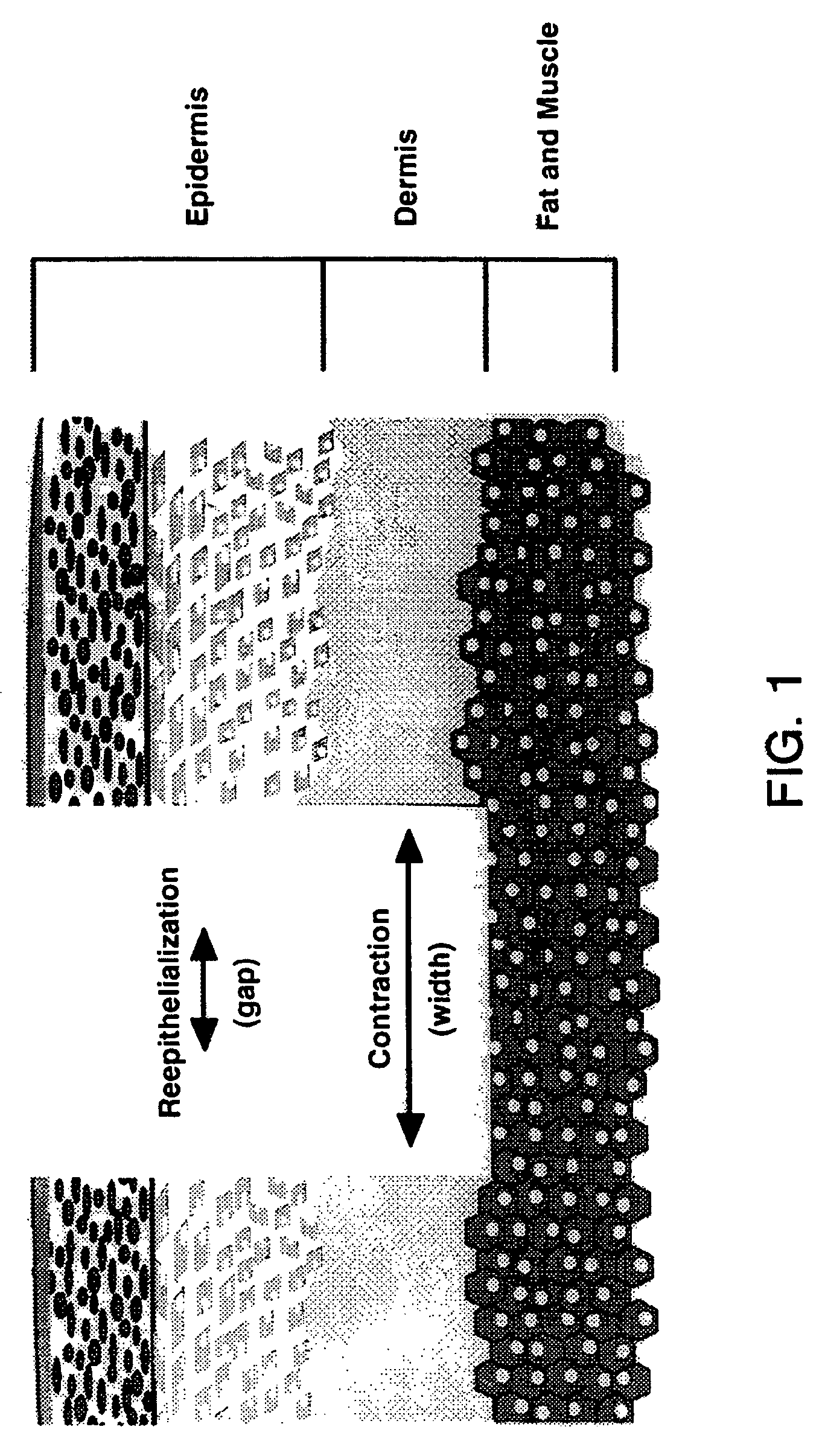 Thymosin beta4 compositions