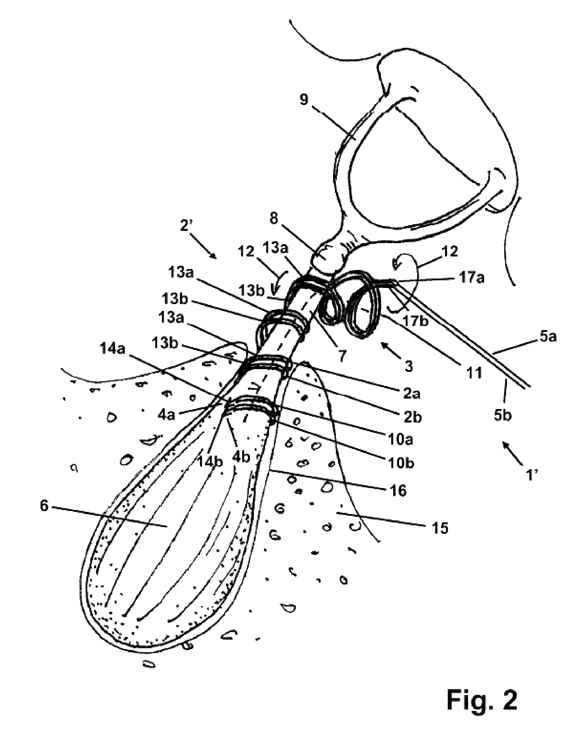 Stapedius muscle electrode