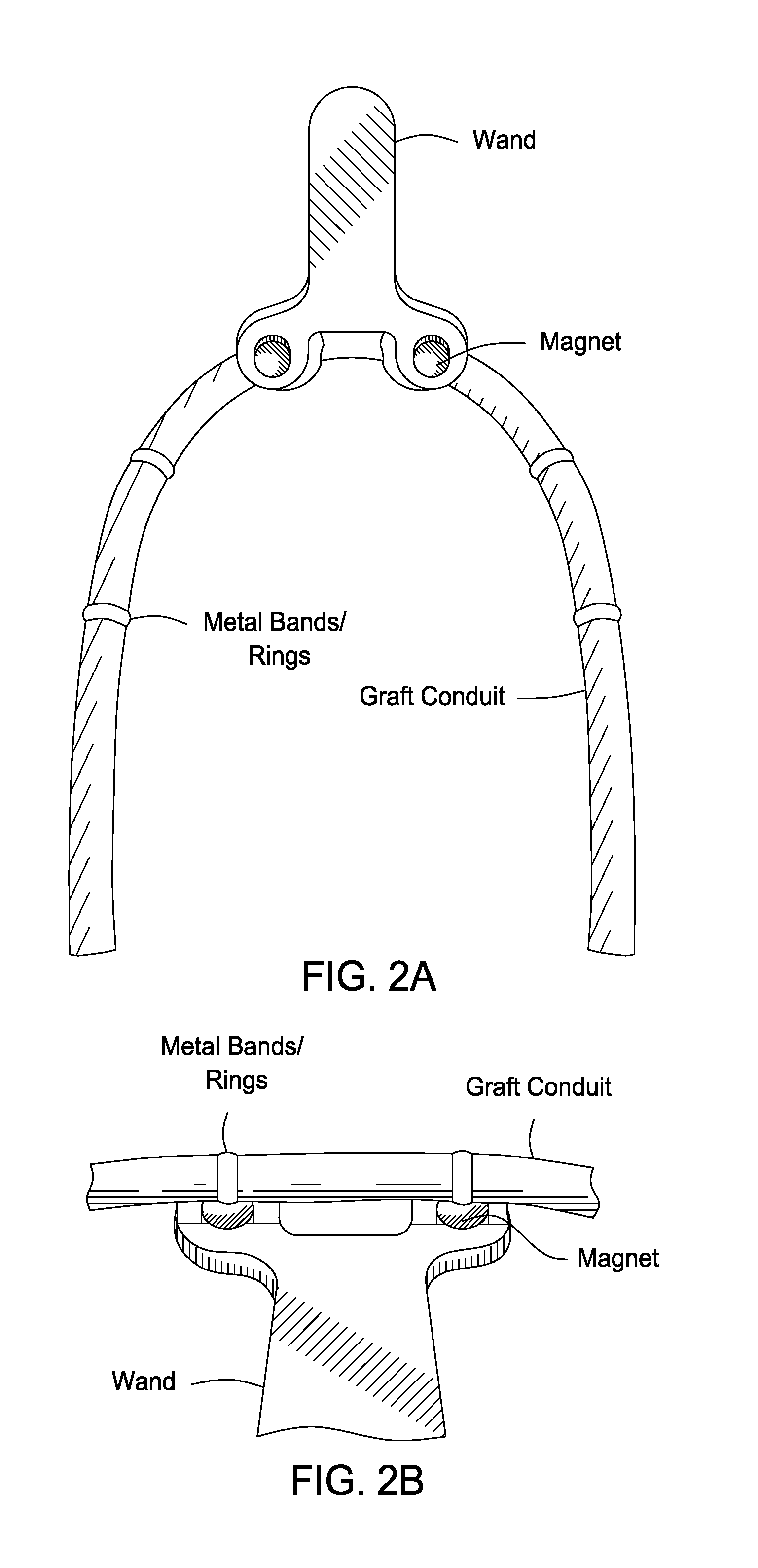 Hemodialysis grafts and methods for localizing and identifying the placement of same