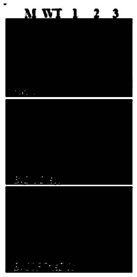 Gene combination expressing and producing betacyanin in rice, and application thereof