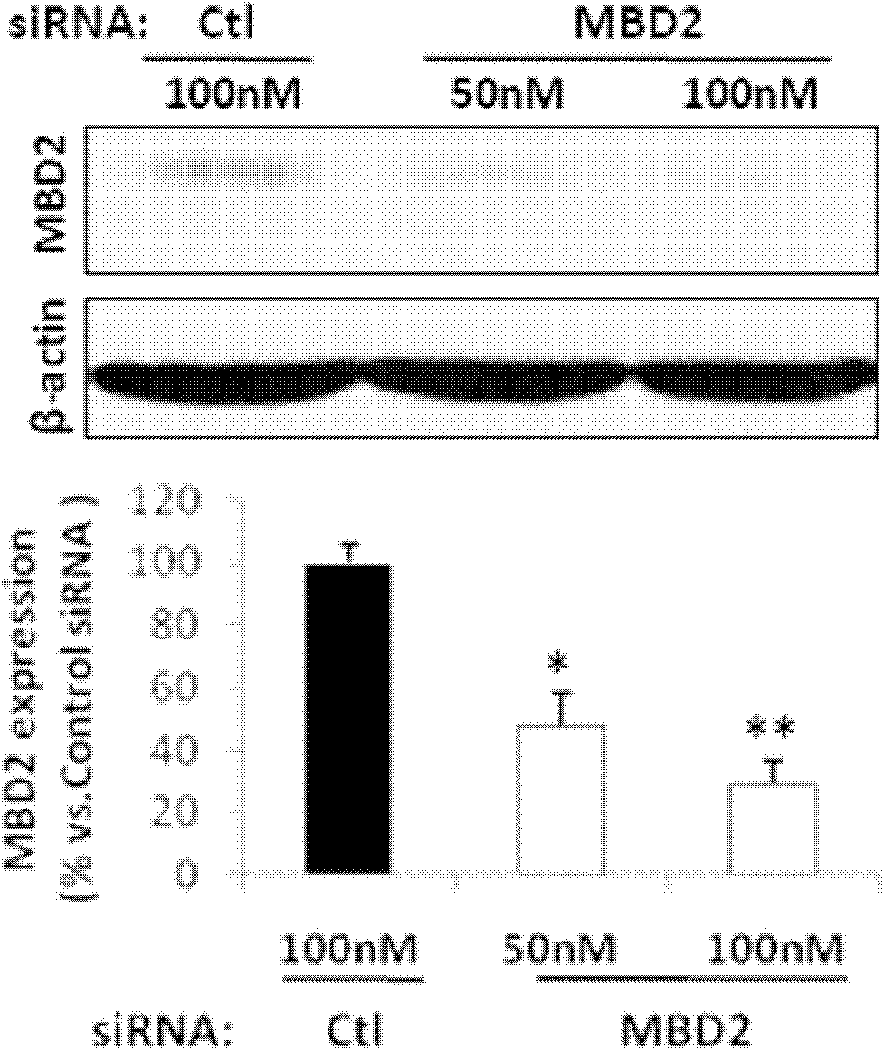 Inhibitor for inhibiting expression of MBD2 and application thereof