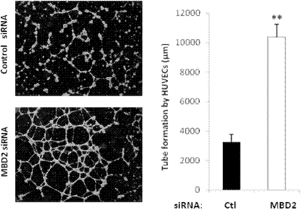 Inhibitor for inhibiting expression of MBD2 and application thereof