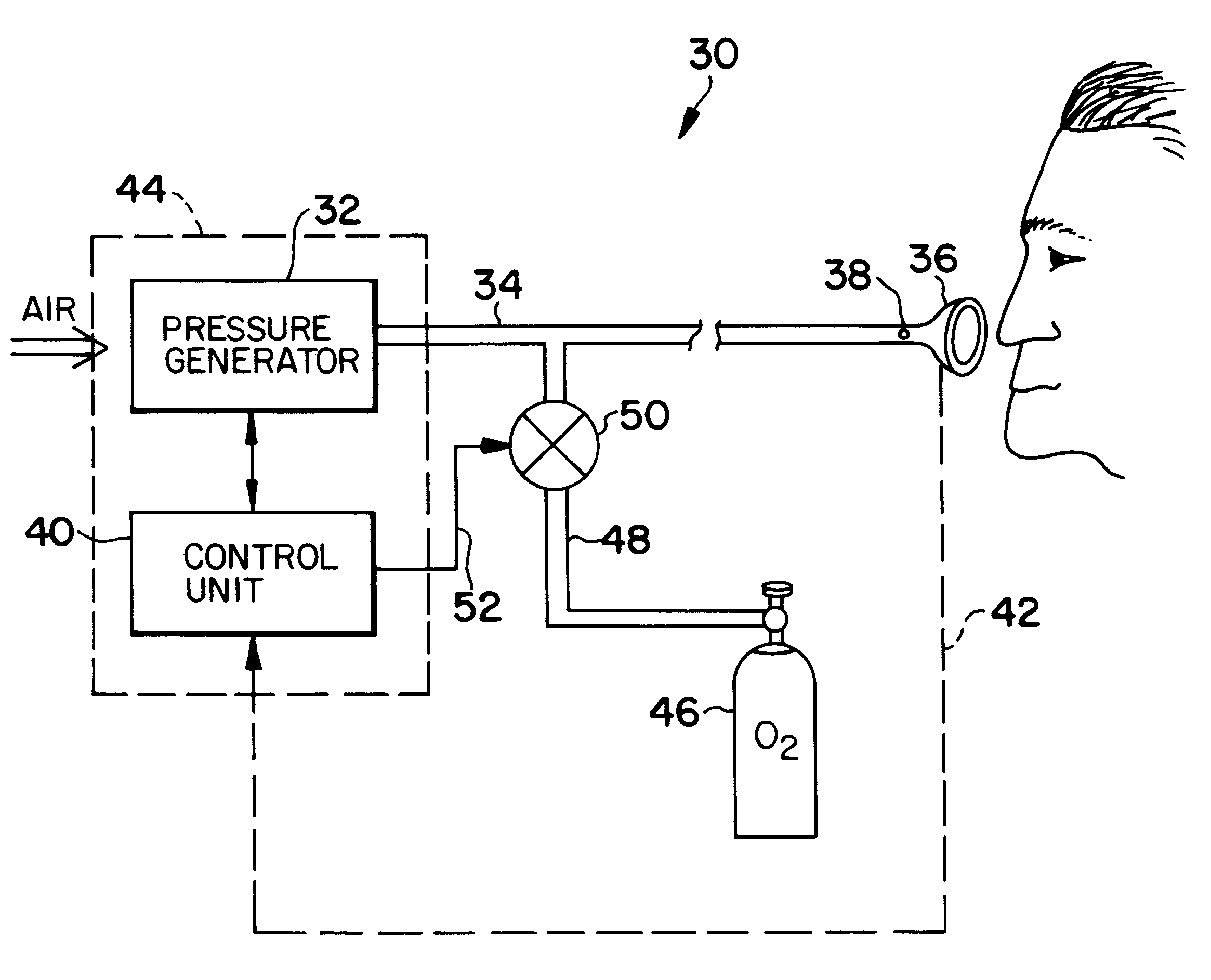 Pressure support system with a primary and a secondary gas flow and a method of using same