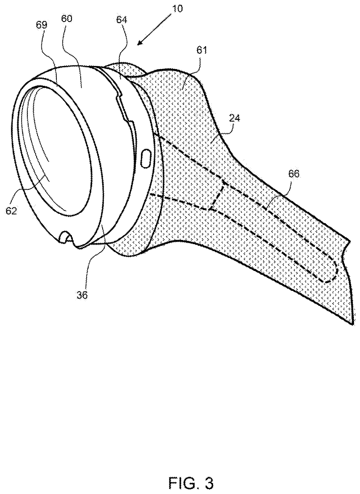 Joint Replacement And In Situ Gauge System