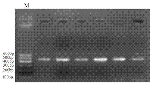 Molecular marking method of using neuroendocrine factor genes to select kidding characters