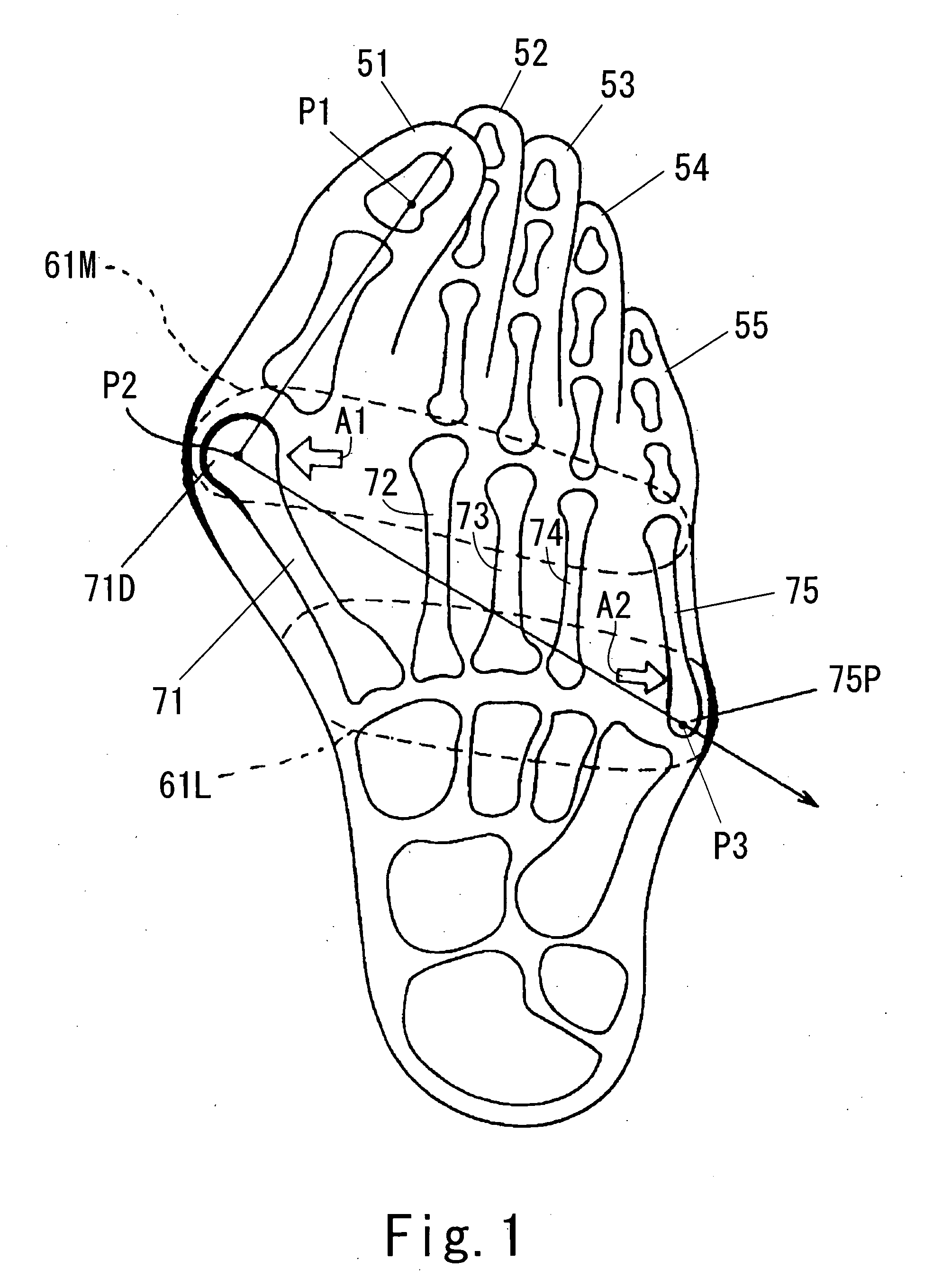 Corrective socks featuring elastic bands and reinforcing bands to correct hallux valgus and digitus quintus varus