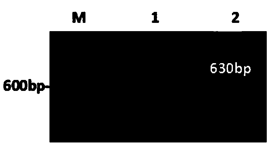 Porcine epidemic diarrhea virus TaqMan fluorescent quantitative RT-PCR kit and detection method thereof