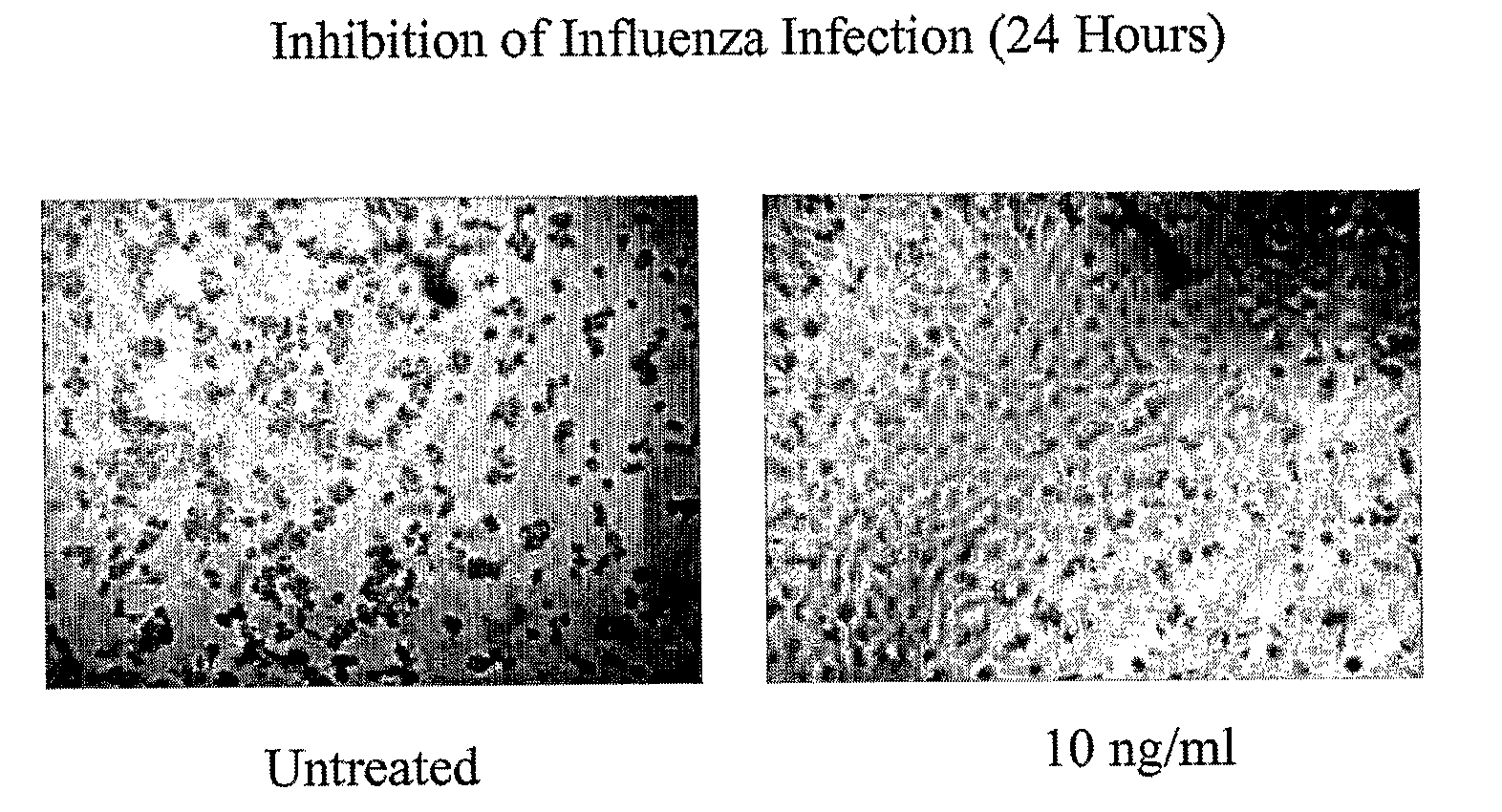 Uses of Recombinant Super-Compound Interferons