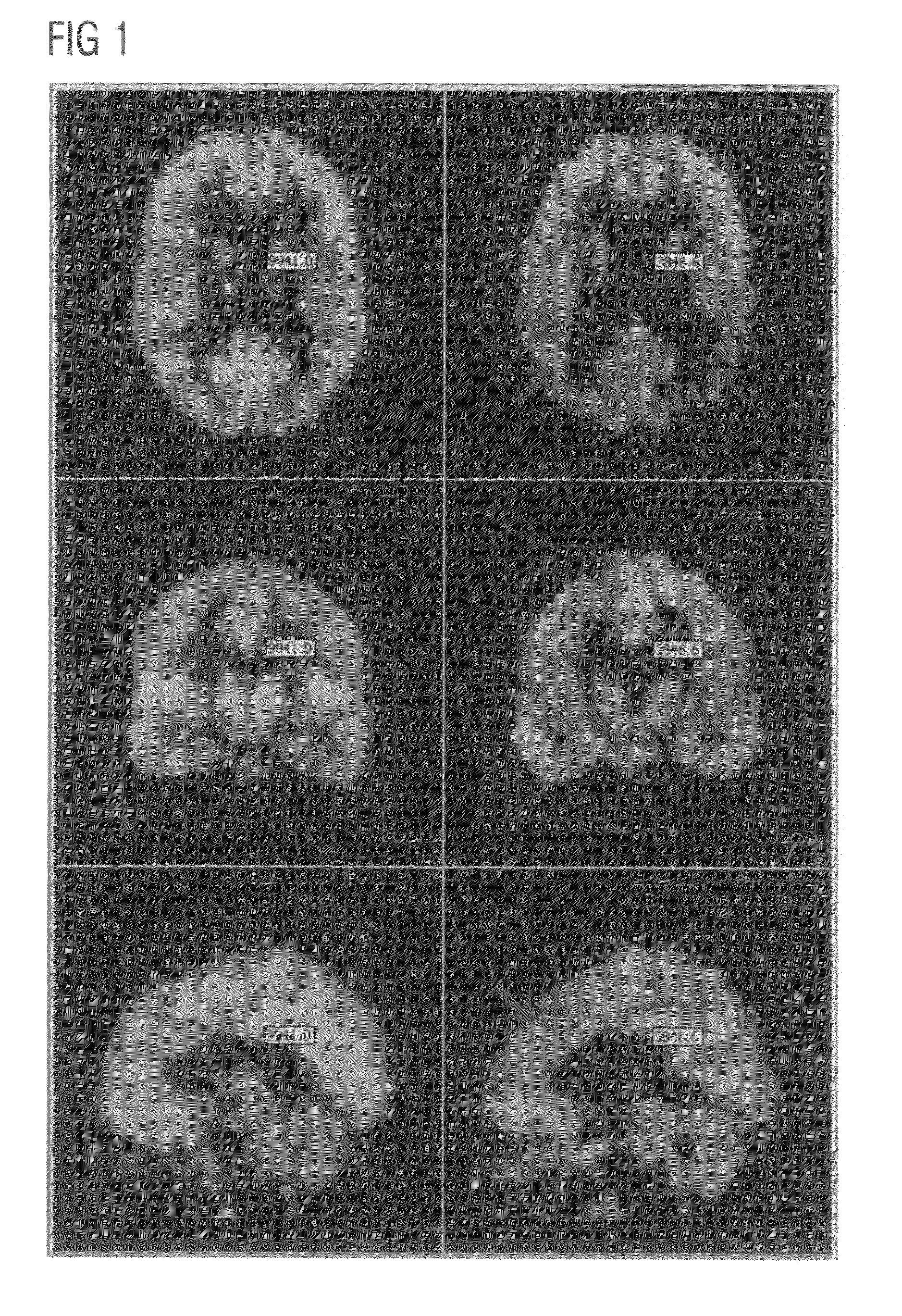 ROI-based assessment of abnormality using transformation invariant features