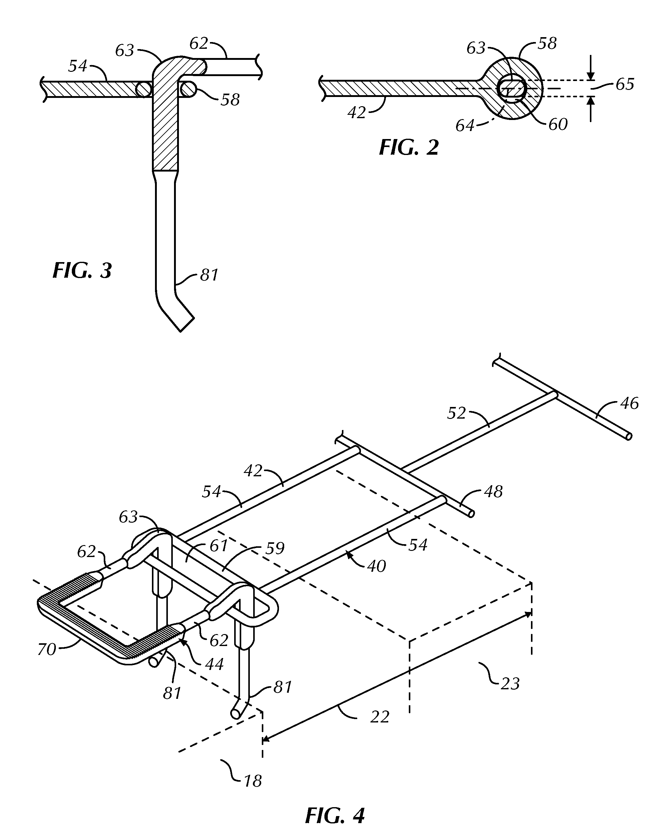 High-strength partially compressed low profile veneer tie and anchoring system utilizing the same