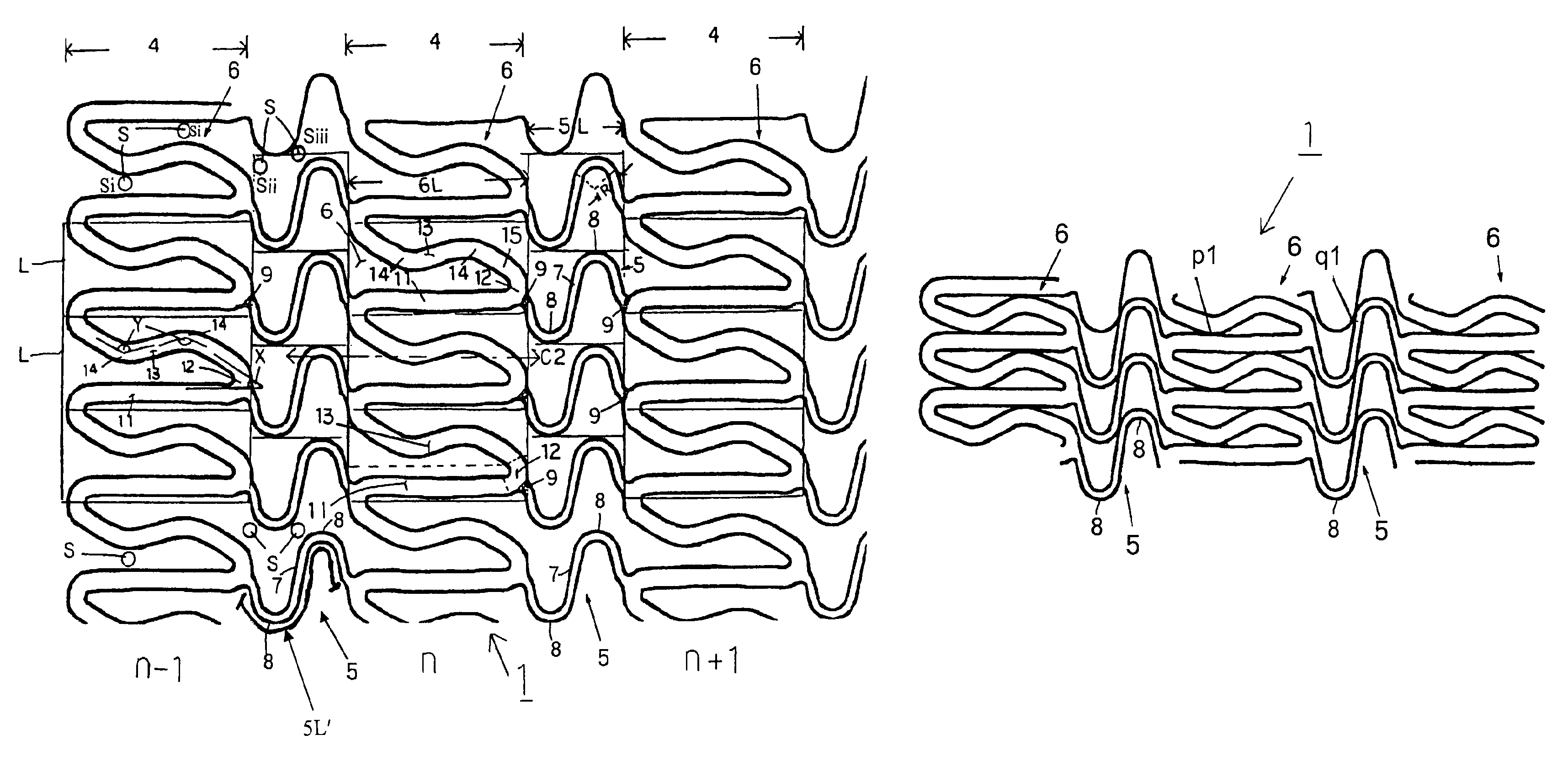 Stent