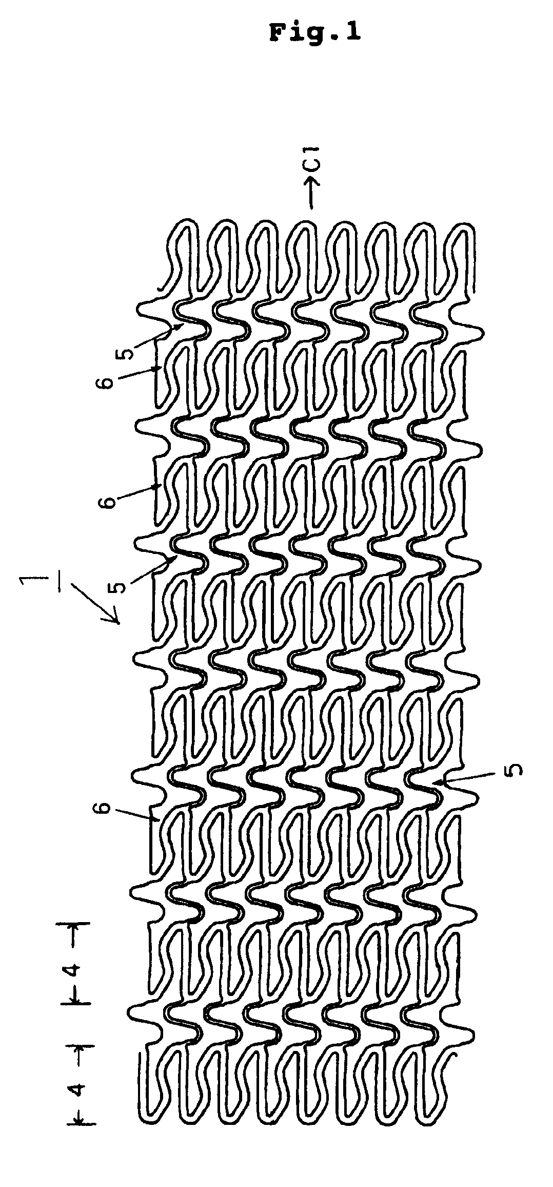 Stent