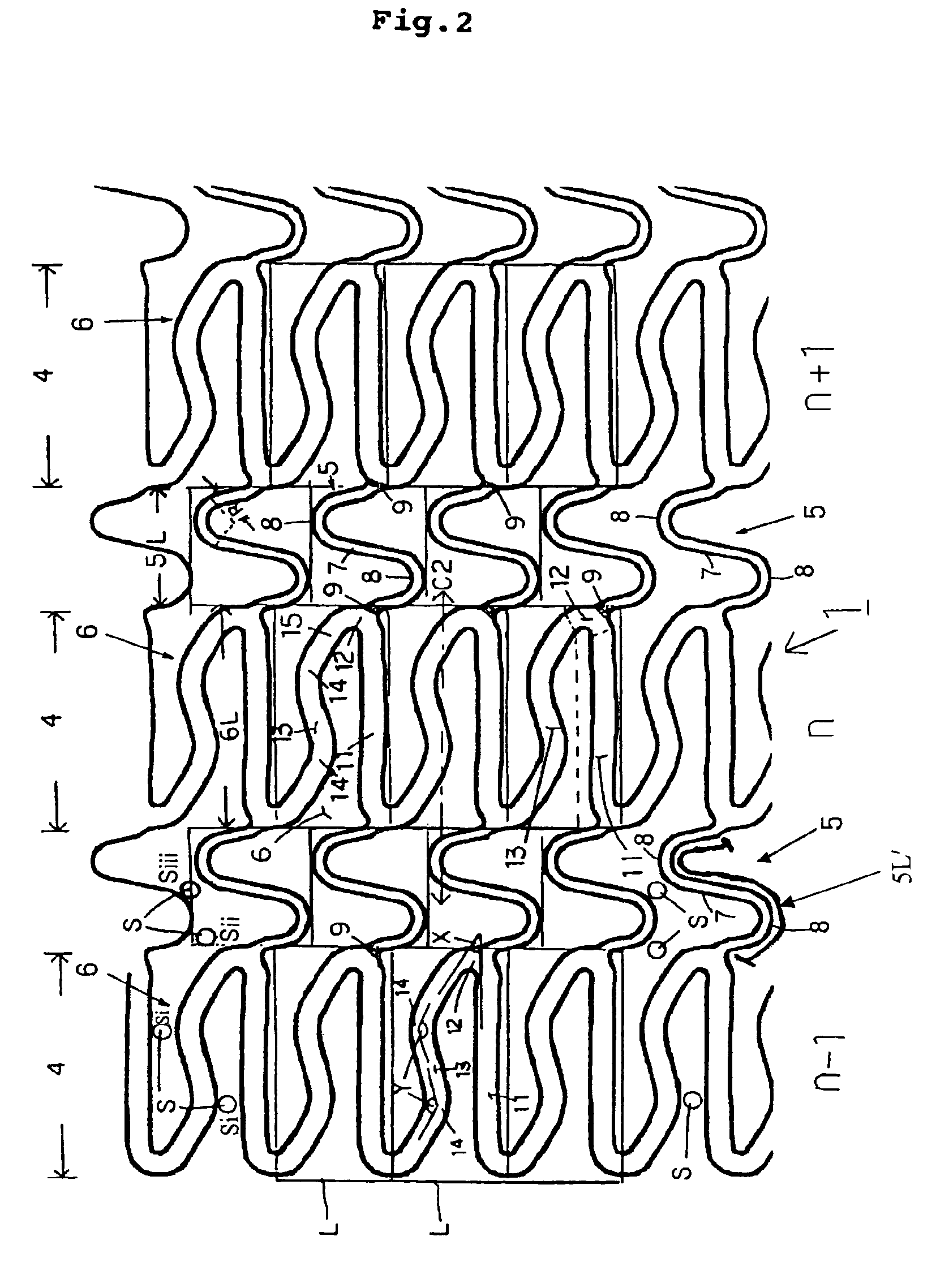 Stent