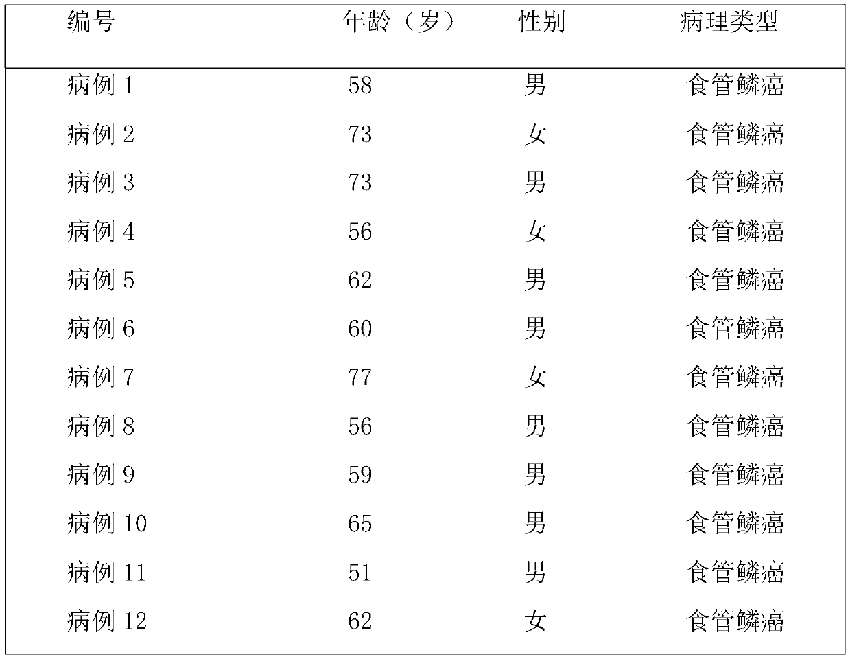 Detection of hsa_circ_0007986 in the serum of patients with esophageal cancer as a new biomarker method and application